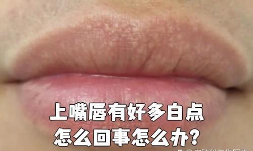 怀孕期间可以吃奥司他韦吗-孕妇感冒能吃奥司他韦胶囊吗网 | 孕妇感冒可以吃奥司他韦吗,孕妇感冒能吃奥司他韦胶囊吗小孩